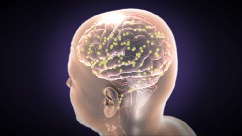 Brain Anesthesia Image